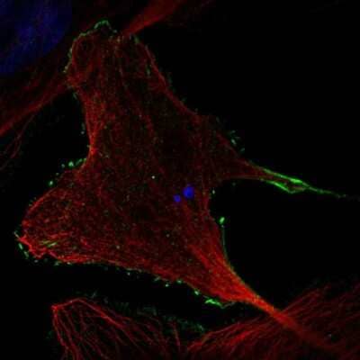 Immunocytochemistry/ Immunofluorescence: RHOBTB2 Antibody [NBP2-32576]