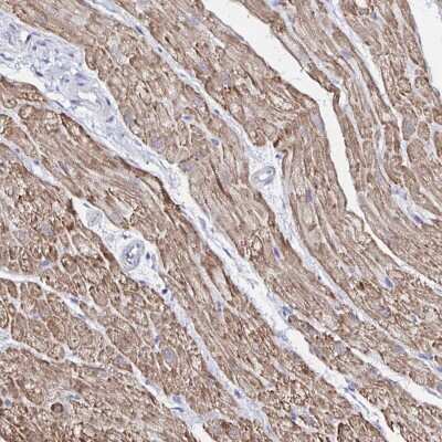 Immunohistochemistry-Paraffin: RHOBTB2 Antibody [NBP2-32576]