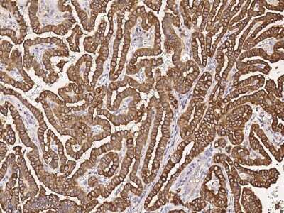 Immunohistochemistry-Paraffin: RHOBTB2 Antibody [NBP2-99192]