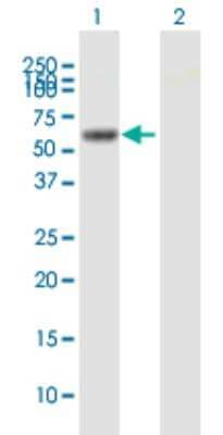 Western Blot: RHOBTB3 Antibody [H00022836-B01P]