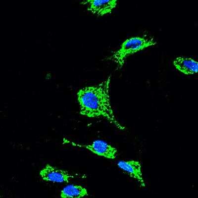 Immunocytochemistry/ Immunofluorescence: RHOT2 Antibody [H00089941-B01P]