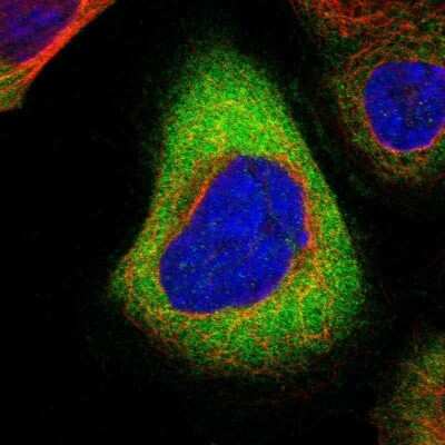 Immunocytochemistry/ Immunofluorescence: RHOT2 Antibody [NBP1-88981]