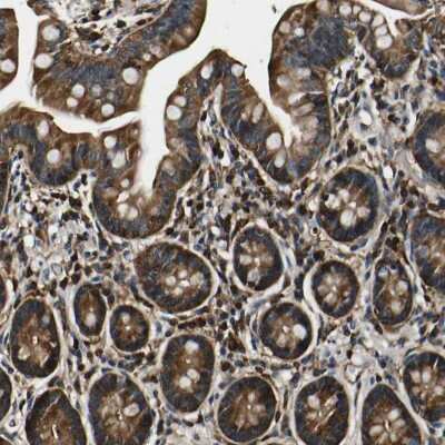 Immunohistochemistry-Paraffin: RHOT2 Antibody [NBP1-88981]