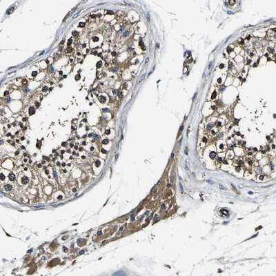 Immunohistochemistry-Paraffin: RHOT2 Antibody [NBP1-88981]