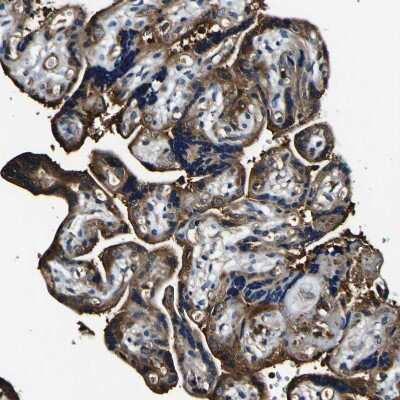 Immunohistochemistry-Paraffin: RHOT2 Antibody [NBP1-88981]