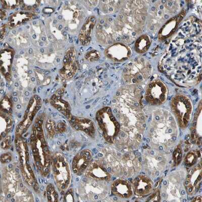 Immunohistochemistry-Paraffin: RHOT2 Antibody [NBP1-88981]