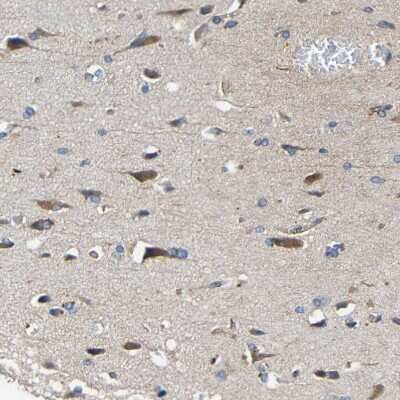 Immunohistochemistry-Paraffin: RHOT2 Antibody [NBP1-88982]