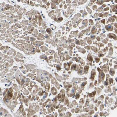 Immunohistochemistry-Paraffin: RHOT2 Antibody [NBP1-88982]