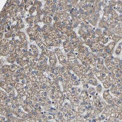 Immunohistochemistry-Paraffin: RHOT2 Antibody [NBP1-88982]