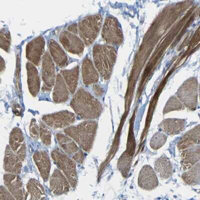 Immunohistochemistry-Paraffin: RHOT2 Antibody [NBP1-88982]