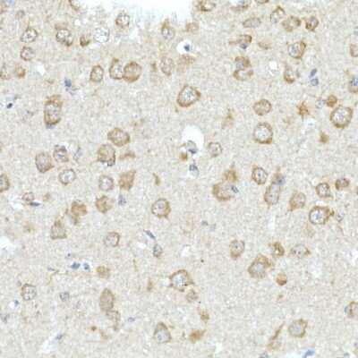 Immunohistochemistry-Paraffin: RHOT2 Antibody - Azide and BSA Free [NBP2-93326]