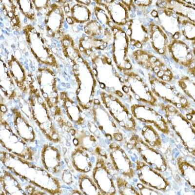 Immunohistochemistry-Paraffin: RHOT2 Antibody - Azide and BSA Free [NBP2-93326]