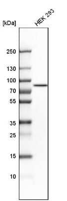 Western Blot: RHOT2 Antibody [NBP1-88982]