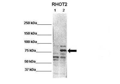 Western Blot: RHOT2 Antibody [NBP2-88153]