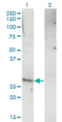 Western Blot: RHOXF1 Antibody (4D12) [H00158800-M01]