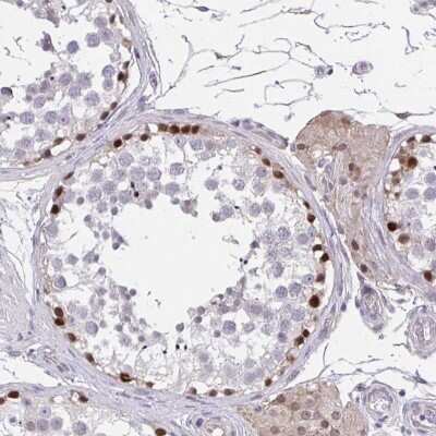 Immunohistochemistry-Paraffin: RHOXF1 Antibody [NBP2-33790]