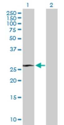 Western Blot: RHOXF1 Antibody [H00158800-B01P]