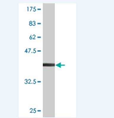 Western Blot: RHOXF2 Antibody (1G6) [H00084528-M01]