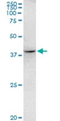 Western Blot: RHOXF2 Antibody (3C4) [H00084528-M07]