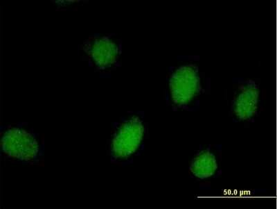 Immunocytochemistry/ Immunofluorescence: RHOXF2 Antibody [H00084528-B01P]