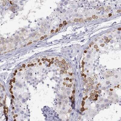 Immunohistochemistry-Paraffin: RHOXF2 Antibody [NBP1-84364]