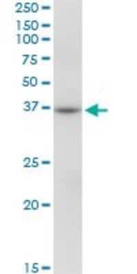 Western Blot: RHOXF2 Antibody [H00084528-B01P]