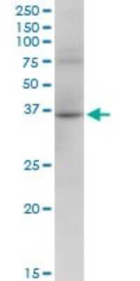 Western Blot: RHOXF2 Antibody [H00084528-B01P]