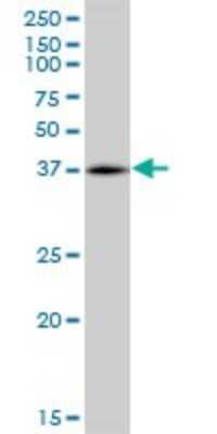 Western Blot: RHOXF2 Antibody [H00084528-B01P]