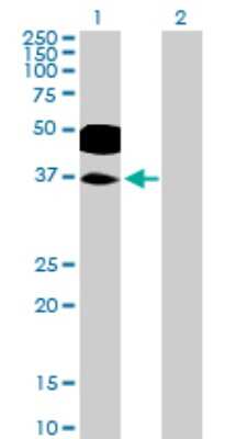 Western Blot: RHOXF2 Antibody [H00084528-B01P]