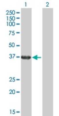 Western Blot: RHOXF2 Antibody [H00084528-B02P]