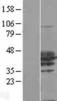 Western Blot: RHOXF2 Overexpression Lysate [NBL1-15362]