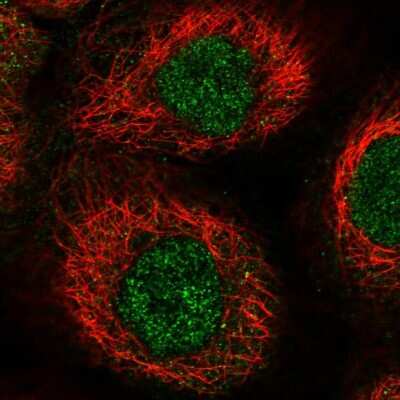 Immunocytochemistry/ Immunofluorescence: RHPN1 Antibody [NBP1-82881]