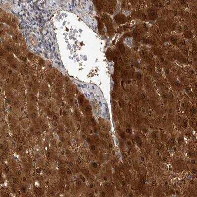 Immunohistochemistry-Paraffin: RHPN1 Antibody [NBP1-82880]