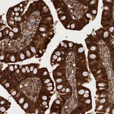 Immunohistochemistry-Paraffin: RHPN1 Antibody [NBP1-82881]