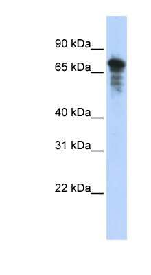 Western Blot: RHPN1 Antibody [NBP1-55003]