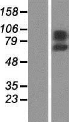 Western Blot: RHPN1 Overexpression Lysate [NBP2-05837]