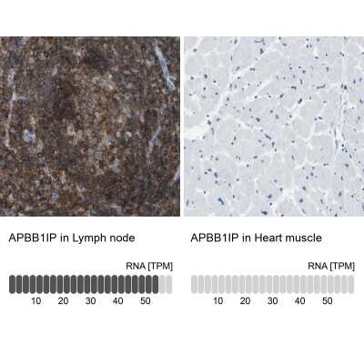 Immunohistochemistry-Paraffin: RIAM/APBB1IP Antibody [NBP2-14300]