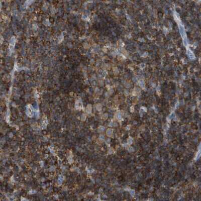 Immunohistochemistry-Paraffin: RIAM/APBB1IP Antibody [NBP2-14300]