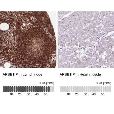 Immunohistochemistry-Paraffin: RIAM/APBB1IP Antibody [NBP2-39009]