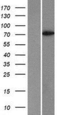 Western Blot: RIAM/APBB1IP Overexpression Lysate [NBP2-06719]