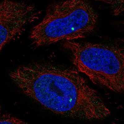 Immunocytochemistry/ Immunofluorescence: RIBC1 Antibody [NBP2-55264]