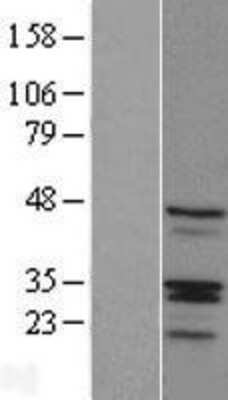 Western Blot: RIBC1 Overexpression Lysate [NBL1-15365]