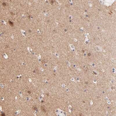 Immunohistochemistry-Paraffin: RIBC2 Antibody [NBP1-86814]