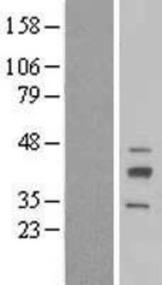 Western Blot: RIBC2 Overexpression Lysate [NBL1-15366]