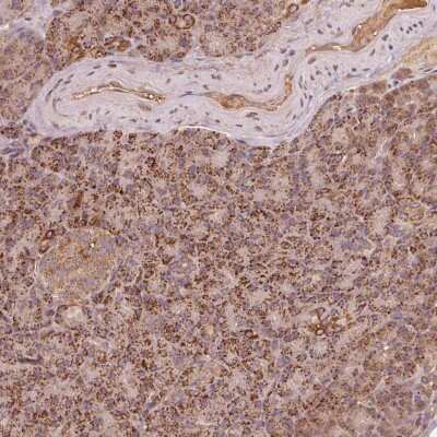 Immunohistochemistry: RIC3 Antibody [NBP2-38058]