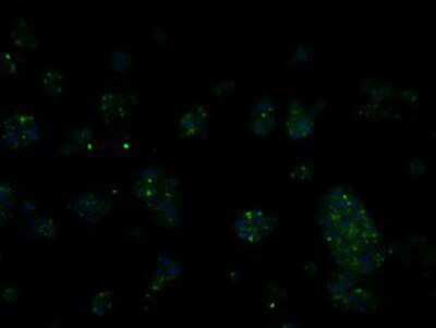 Immunocytochemistry/ Immunofluorescence: RIC8A Antibody (OTI3G3) [NBP2-02433]