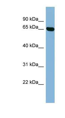 Western Blot: RIC8B Antibody [NBP1-56878]