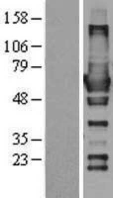 Western Blot: RIC8A Overexpression Lysate [NBL1-15368]