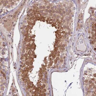 Immunohistochemistry: RIC8A Antibody [NBP2-47304]