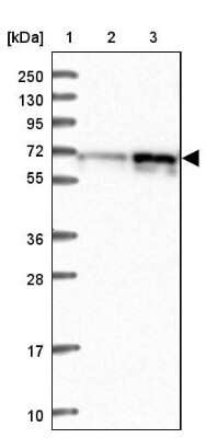 Western Blot: RIC8A Antibody [NBP2-47304]